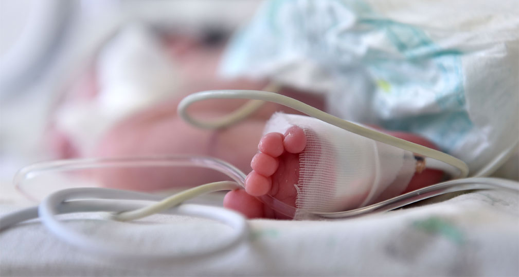 Paediatrics Intensive Care