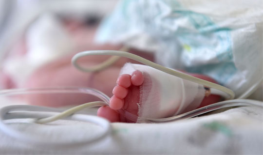 Paediatrics Intensive Care